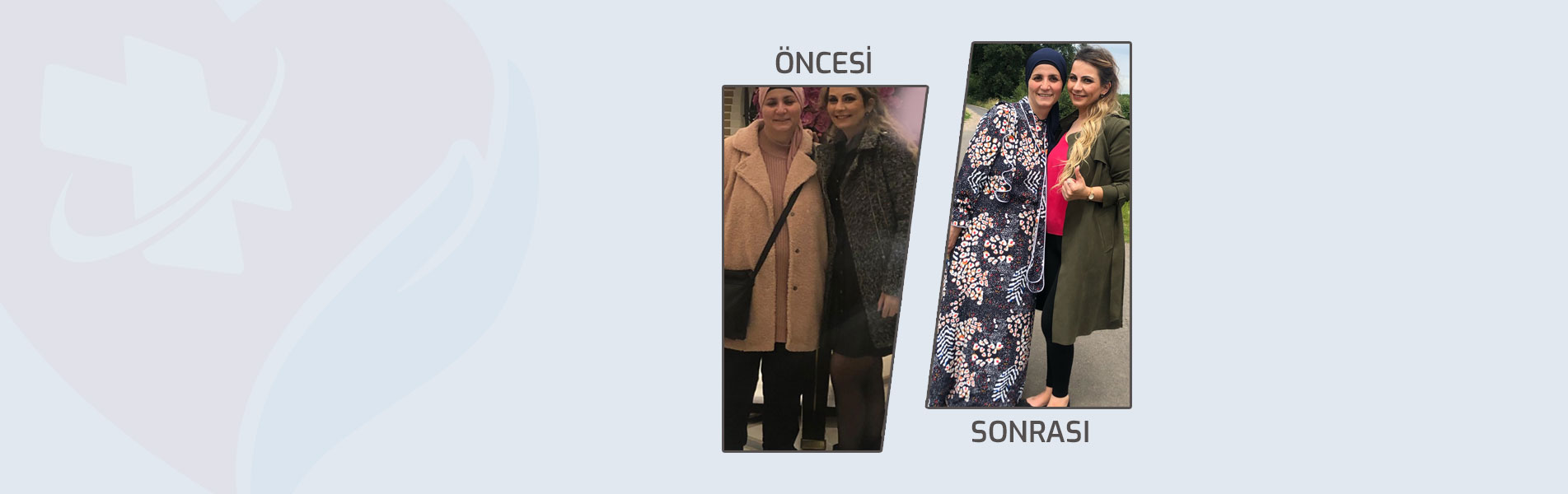 obezite-before-after2