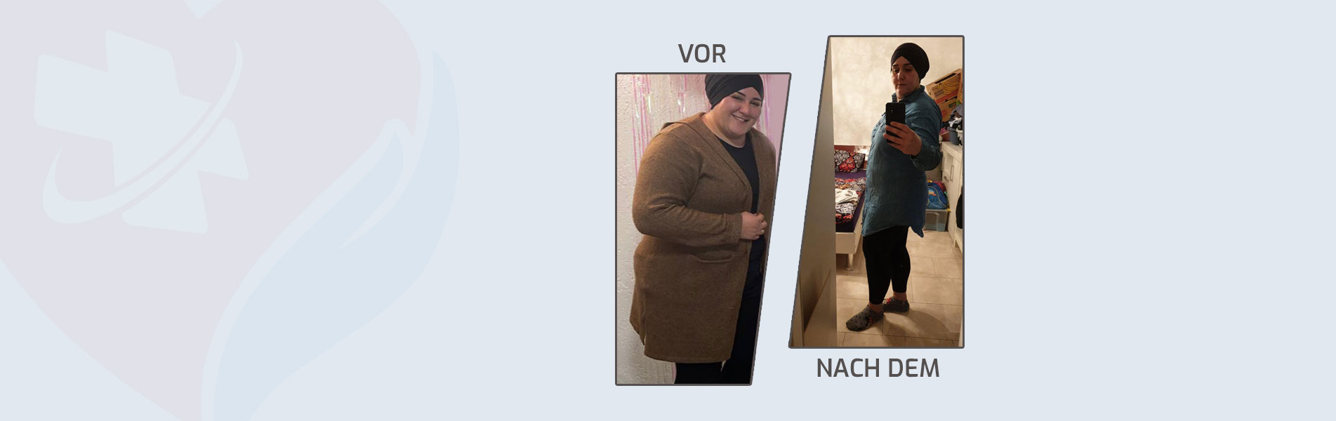 alm-before-after-1